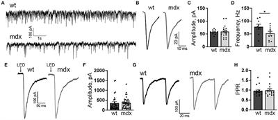 Altered Synaptic Transmission and Excitability of Cerebellar Nuclear Neurons in a Mouse Model of Duchenne Muscular Dystrophy